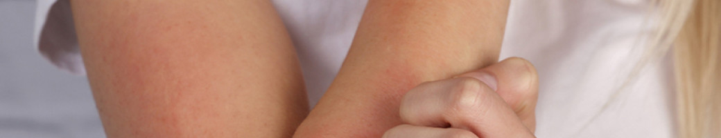 Ατοπική Δερματίτιδα Ατοπική Δερματίτιδα