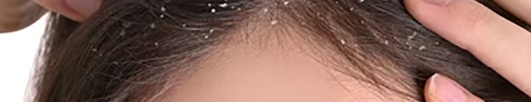 Πιτυρίδα Πιτυρίδα